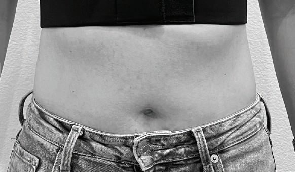 After BAUD Liftwear — case 3, Postpartum, age 38